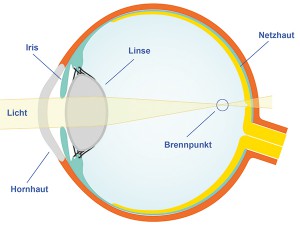 kurzsichtigkeit