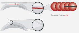 3D Femto-LASIK Z (Niedrigenergielaser) Mit dem sehr kleinen Fokus sind besonders kleine und energiearme Schnittpulse möglich. Durch die Überlagerung der Pulse erfolgt eine vollständige glatte Gewebetrennung