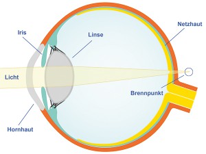 weitsichtigkeit