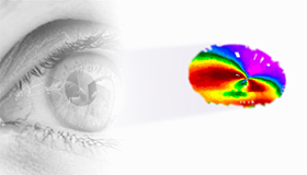 Wellenfrontanalyse Diese Untersuchung zeigt genau jeden optischen Fehler der Hornhautoberfläche und fließt in die Laserbehandlung ein.