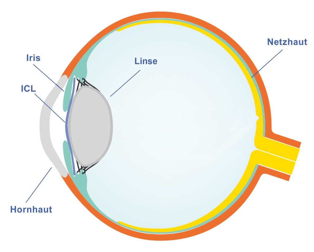 Auge Illustration mit ICL Auge Illustration mit ICL